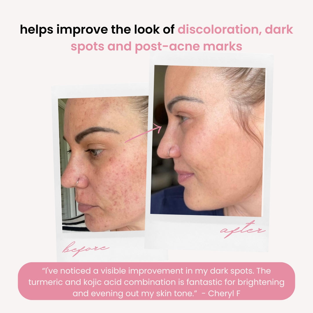 Pro-Strength Turmeric + Kojic Acid Pads — Brighten, Clarify & Even Tone Like a Pro